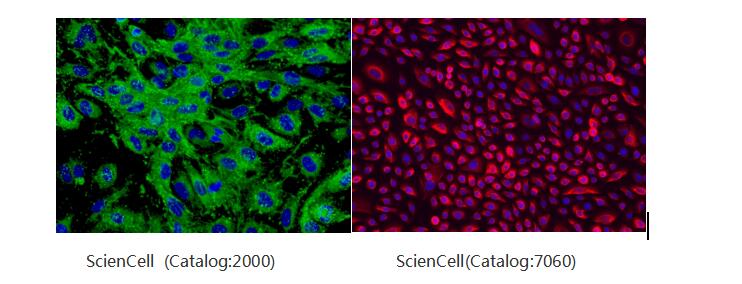 中乔新舟 生物科技 细胞培养方法 原代细胞和细胞系的差别 生物技术 人主动脉内皮细胞 原代细胞