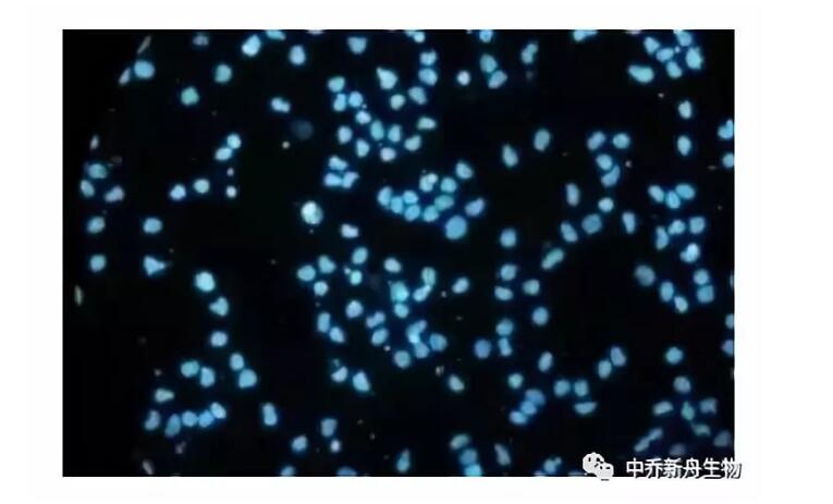 中乔新舟 生物科技 细胞培养方法 原代细胞和细胞系的差别 生物技术 支原体 支原体检测