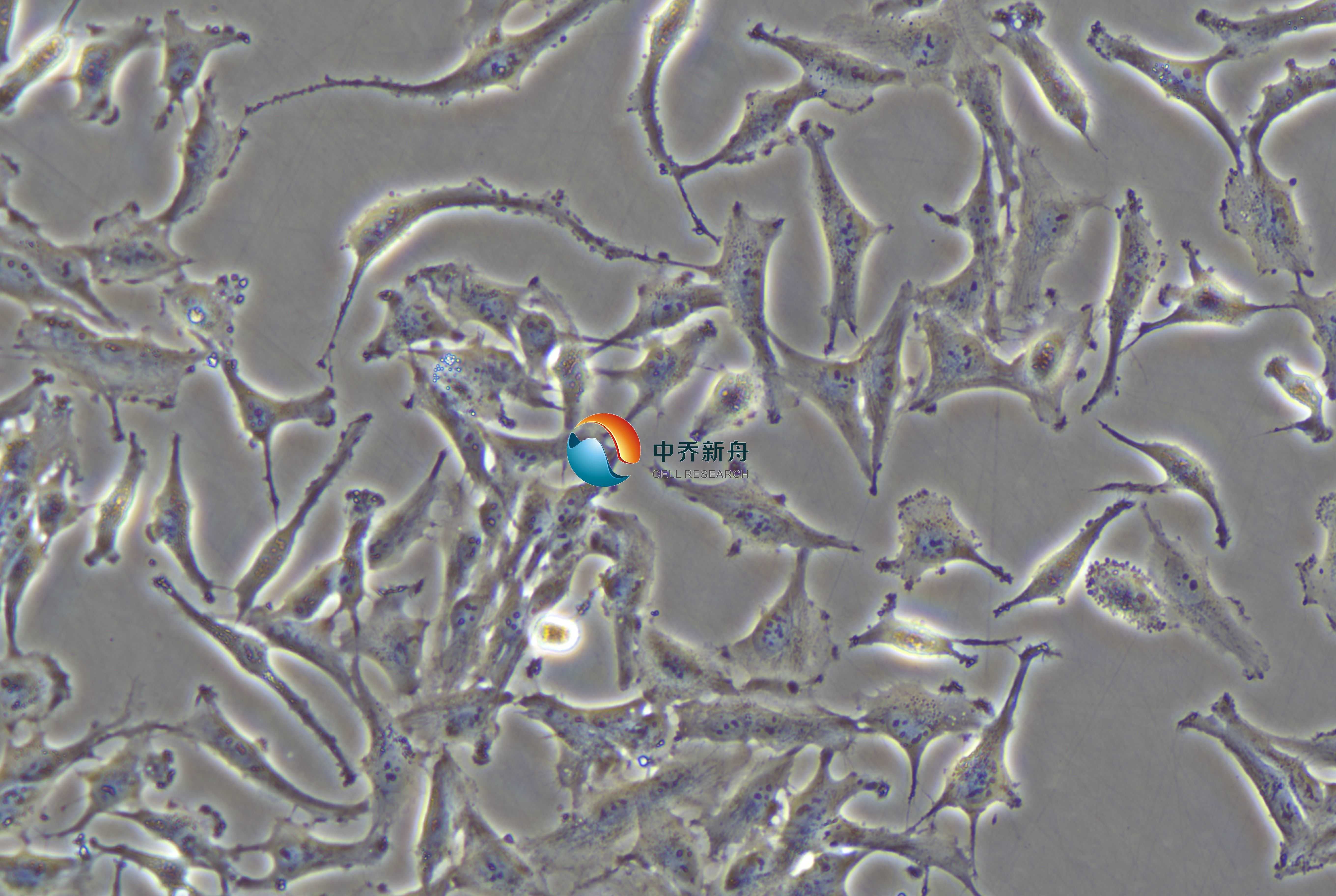 U251细胞-细胞株-人神经胶质瘤细胞-中乔新舟生物科技有限公司