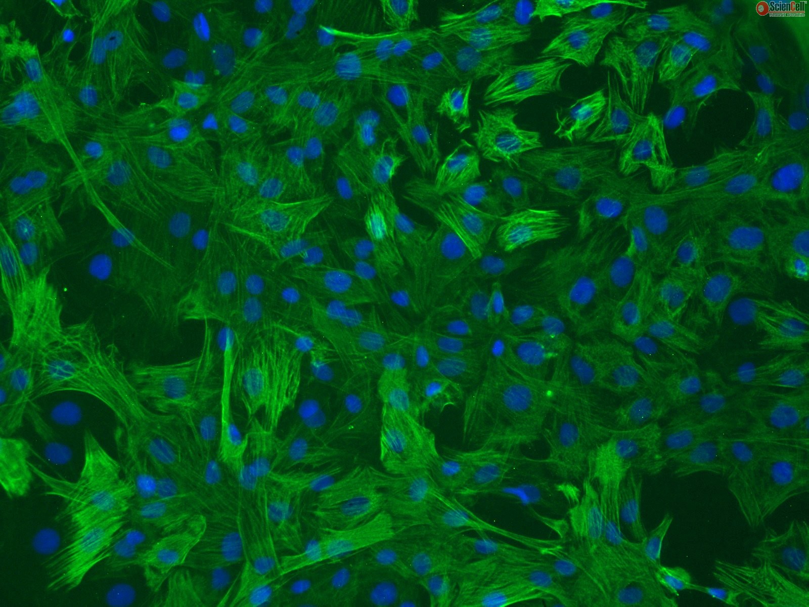 大鼠主动脉平滑肌细胞 英文名:rat aortic smooth muscle cells 货号